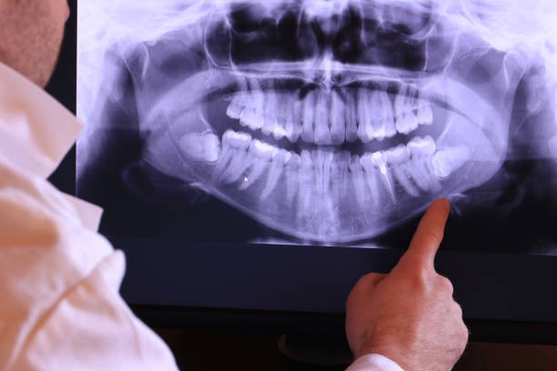 Best Emergency Root Canal Treatment in Weyers Cave, VA