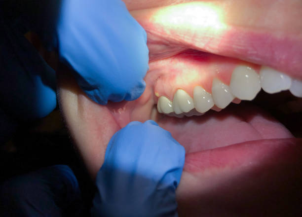 Best Pediatric Emergency Dentist in Weyers Cave, VA