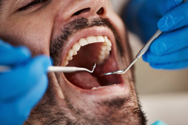 Best Pediatric Emergency Dentist in Weyers Cave, VA